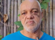 prótese dentária